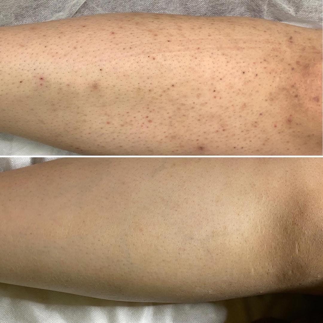 Pegang botol Sang Bulu