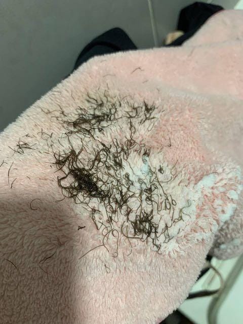 Kaki licin selepas gunakan produk