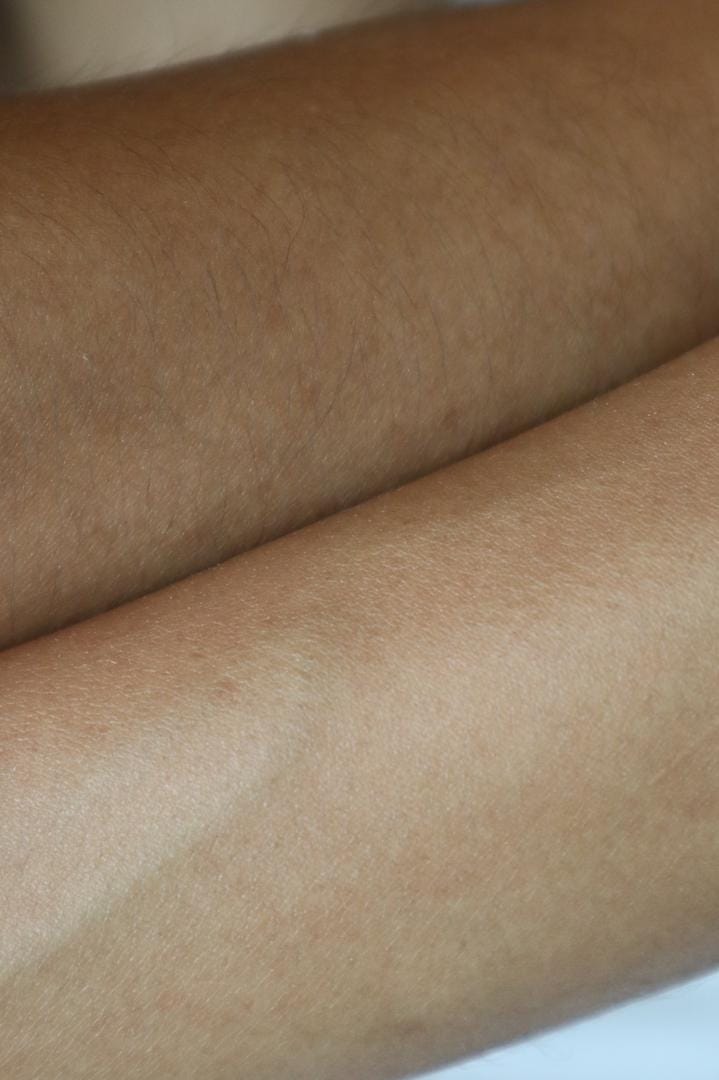 Kulit cerah dan lembut selepas rawatan